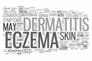 food allergies and eczema