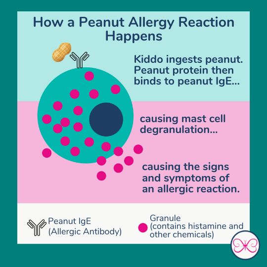 What Are Ige Mediated Life Threatening Food Allergies